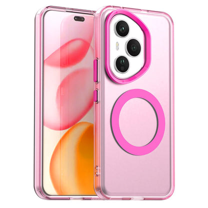 Capa MagSafe para Honor 400 Pro, Techsuit, CandyCase, Rosa