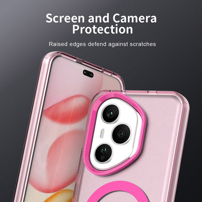 Capa MagSafe para Honor 400 Pro, Techsuit, CandyCase, Rosa